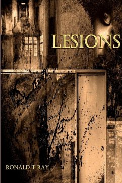 Lesions - Ray, Ronald T