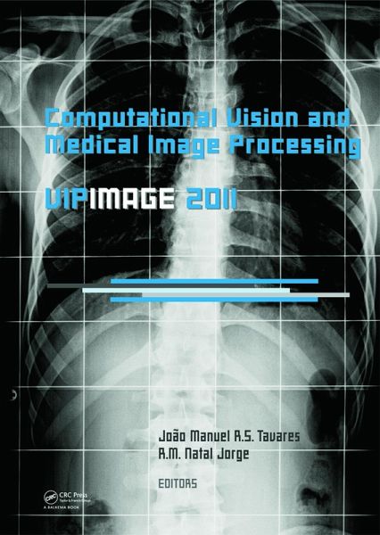 Computational Vision and Medical Image Processing: VipIMAGE 2011 (eBook, PDF) Computational Vision and Medical Image Processing: VipIMAGE 2011 (eBook, PDF)