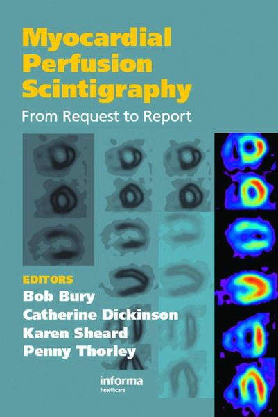 Myocardial Perfusion Scintigraphy (eBook, PDF) Myocardial Perfusion Scintigraphy (eBook, PDF)