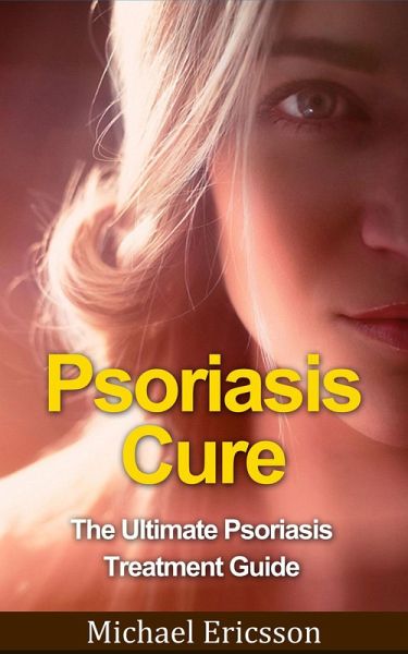 Psoriasis Cure: The Ultimate Psoriasis Treatment Guide (eBook, ePUB)