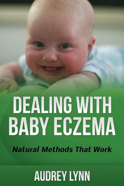 Dealing With Baby Eczema (eBook, ePUB)
