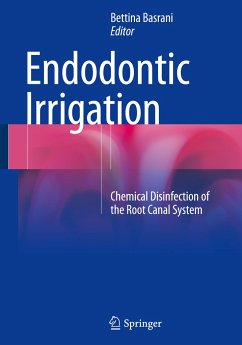 Endodontic Irrigation