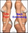 Tolle Figur - Nach Entbindung (eBook,... - Bild 1