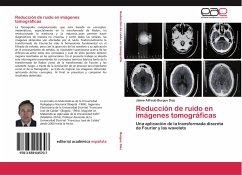 Reducción de ruido en imágenes tomográficas - Burgos Díaz, Jaime Alfredo