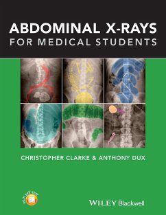 Abdominal X-rays for Medical Students - Clarke, Christopher; Dux, Anthony