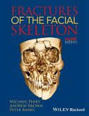 Fractures of the Facial Skelet