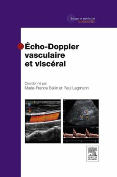 Echo-Doppler vasculaire et viscéral (eBook, ePUB) - Bellin, Marie-France; Legmann, Paul
