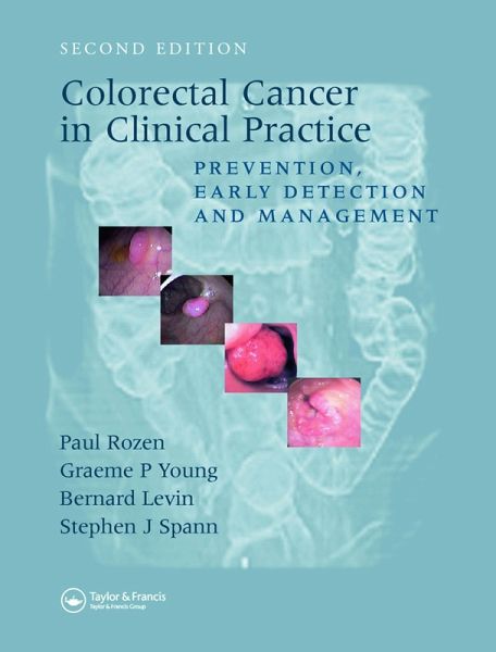 Colorectal Cancer in Clinical Practice (eBook, PDF) Colorectal Cancer in Clinical Practice (eBook, PDF)
