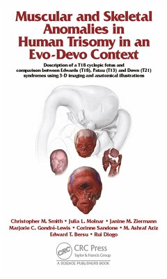 Muscular and Skeletal Anomalies in Human Trisomy in an Evo-Devo Context (eBook, PDF) - Diogo, Rui; Smith, Christopher M.; Ziermann, Janine M.; Molnar, Julia; Gondre-Lewis, Marjorie C.; Sandone, Corinne; Bersu, Edward T.; Aziz, Mohammed Ashraf