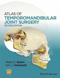Cover Atlas of Temporomandibular Joint Surgery (eBook, PDF)