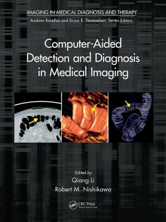 Computer-Aided Detection and Diagnosis in Medical Imaging (eBook, PDF)