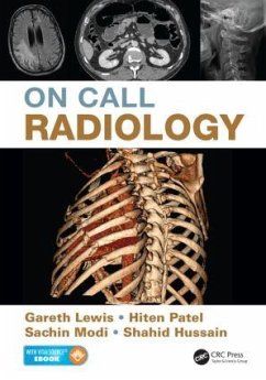 On Call Radiology - Lewis, Gareth; Modi, Sachin; Patel, Hiten