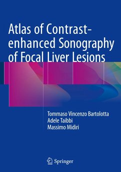 Atlas of Contrast-enhanced Sonography of Focal Liver Lesions - Taibbi, Adele;Midiri, Massimo;Bartolotta, Tommaso Vincenzo