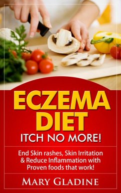 Eczema Diet: Itch No More! End Skin rashes, skin irritation & reduce inflammation with A Low Inflammation Diet & Proven foods that work! BONUS know what to avoid! (eBook, ePUB) - Gladine, Mary