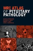 MRI Atlas of Pituitary Pathology (eBook, ePUB)
