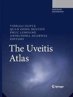 The Uveitis Atlas