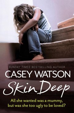 Skin Deep - Watson, Casey