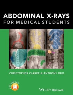 Cover Abdominal X-rays for Medical Students (eBook, ePUB)