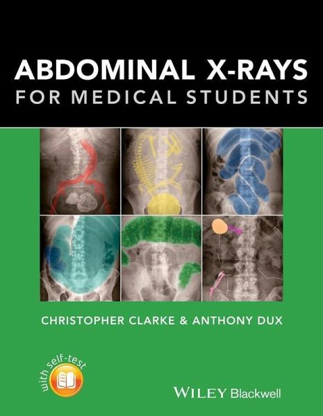 Abdominal X-rays for Medical Students (eBook, ePUB)