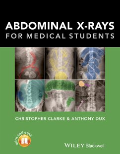 Abdominal X-rays for Medical Students (eBook, PDF) - Clarke, Christopher; Dux, Anthony
