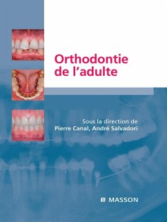 Orthodontie de l'adulte (eBook, ePUB) - Canal, Pierre; Salvadori, André