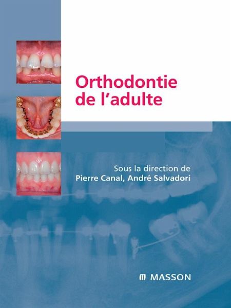Orthodontie de l'adulte (eBook, ePUB) Orthodontie de l'adulte (eBook, ePUB)