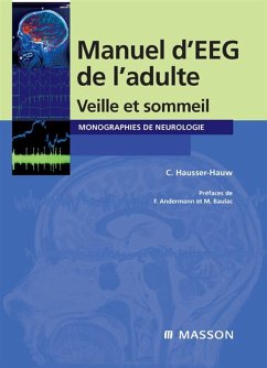 Manuel d'EEG de l'adulte (eBook, ePUB) - Hausser-Hauw, Chantal