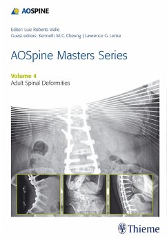 Aospine Master Series, Vol. 4: Adult Spinal Deformities