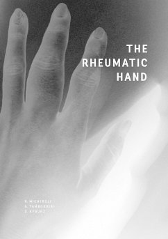 The Rheumatic Hand