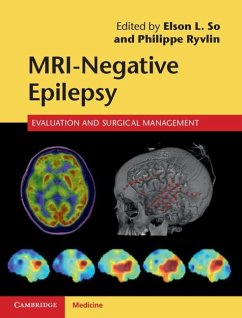 Cover MRI-Negative Epilepsy (eBook, ePUB)