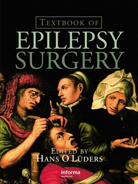 Textbook of Epilepsy Surgery (eBook, PDF) Textbook of Epilepsy Surgery (eBook, PDF)