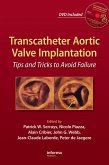 Transcatheter Aortic Valve Implantation (eBook, PDF)