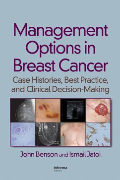Management Options in Breast Cancer (eBook, PDF) - Benson, John; Jatoi, Ismail