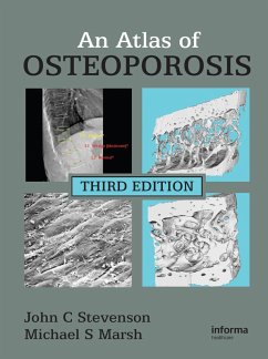 An Atlas of Osteoporosis (eBook, PDF) - Stevenson, John C.; Marsh, Michael S.