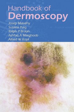 Handbook of Dermoscopy (eBook, PDF) - Malvehy, Josep; Braun, Ralph P.; Puig, Susana; Marghoob, Ashfaq A.; Kopf, Alfred W.