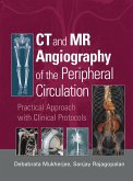 CT and MR Angiography of the Peripheral Circulation (eBook, PDF)