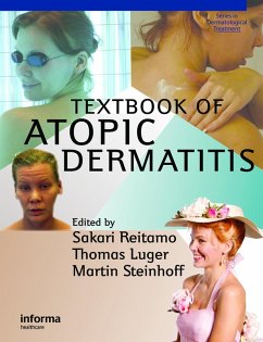 Textbook of Atopic Dermatitis (eBook, PDF) - Reitamo, Sakari; Luger, Thomas A.; Steinhoff, Martin