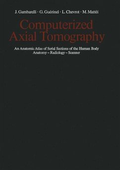 COMPUTERIZED AXIAL TOMOGRAPHY. an anatomic atlas of serial sections of the human body ; anatomy, radiology, scanner COMPUTERIZED AXIAL TOMOGRAPHY. an anatomic atlas of serial sections of the human body ; anatomy, radiology, scanner