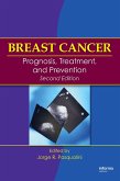 Breast Cancer (eBook, PDF)