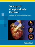 Tomografía computarizada cardíaca : principios, técnica y aplicaciones clínicas