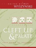 Cleft Lip and Palate (eBook, ePUB)