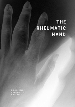 The Rheumatic Hand (eBook, ePUB)