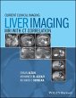 Liver Imaging (eBook, ePUB) - Bild 1