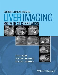 Cover Liver Imaging (eBook, PDF)