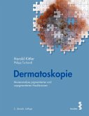 Dermatoskopie (eBook, PDF)