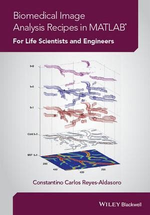 Biomedical Image Analysis Recipes in MATLAB (eBook, ePUB) Biomedical Image Analysis Recipes in MATLAB (eBook, ePUB)