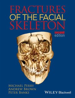 Fractures of the Facial Skeleton (eBook, PDF) - Perry, Michael; Brown, Andrew K.; Banks, Peter