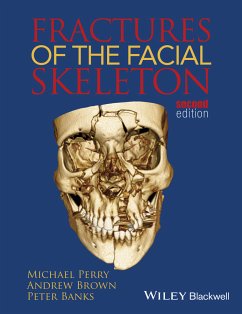 Fractures of the Facial Skeleton (eBook, PDF) - Perry, Michael; Brown, Andrew K.; Banks, Peter