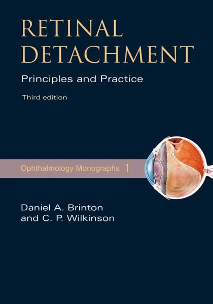 Retinal Detachment (eBook, ePUB)