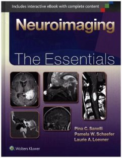 Neuroimaging - Sanelli, Pina C.; Schaefer, Pamela W.; Loevner, Laurie A.